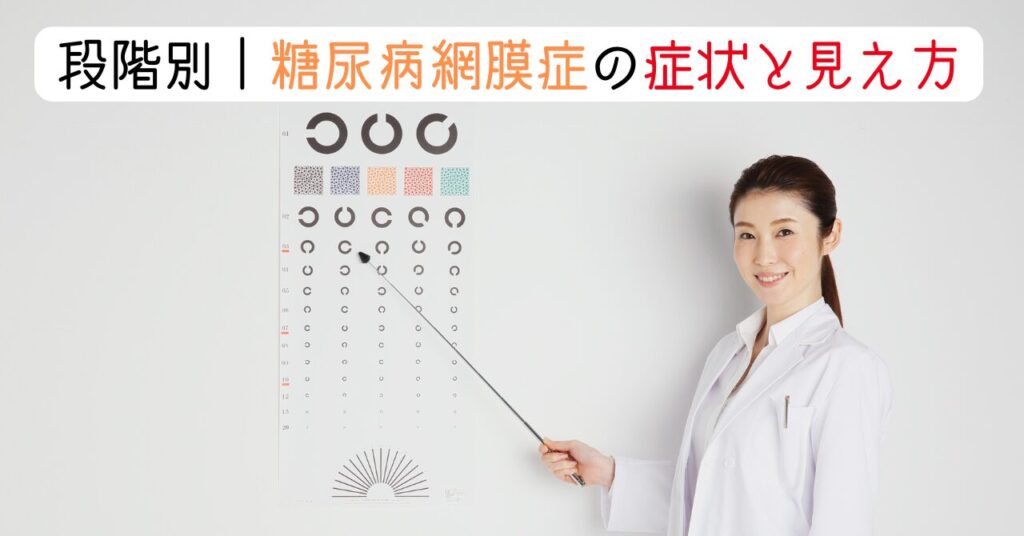段階別｜糖尿病網膜症の症状と見え方　見出し画像